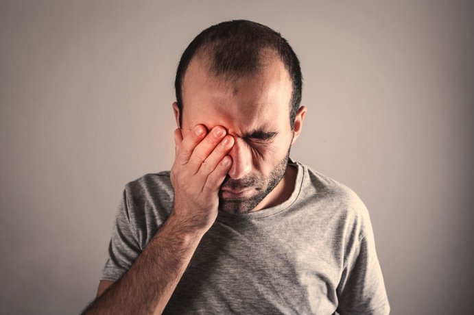 ©andranik123 - stock.adobe.com Mann mit Bindehaut reibt sich die Augen.